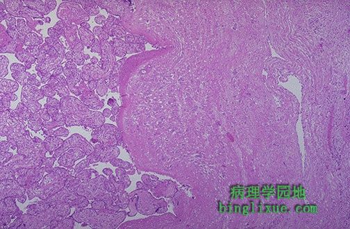重庆的赠卵试管婴儿费用高吗？该技术如何？