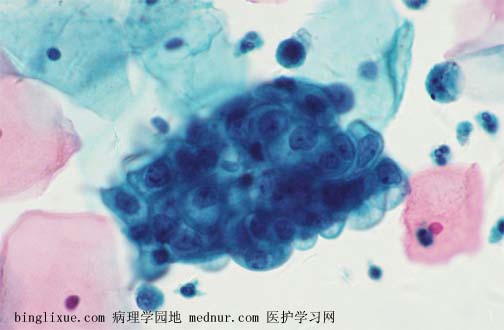 海外供卵试管医院当日移植胚胎？移植后需要