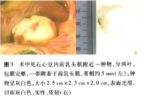 海外供卵试管医院当日移植胚胎？移植后需要卧床多长时间