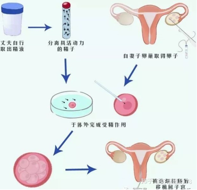 做供卵借卵试管婴儿真的会痛吗？