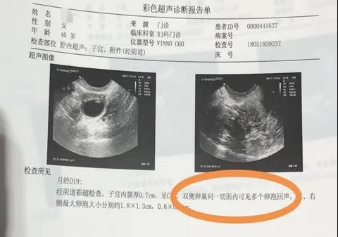 做武汉第三代供卵做试管供卵自怀的成功率高吗？