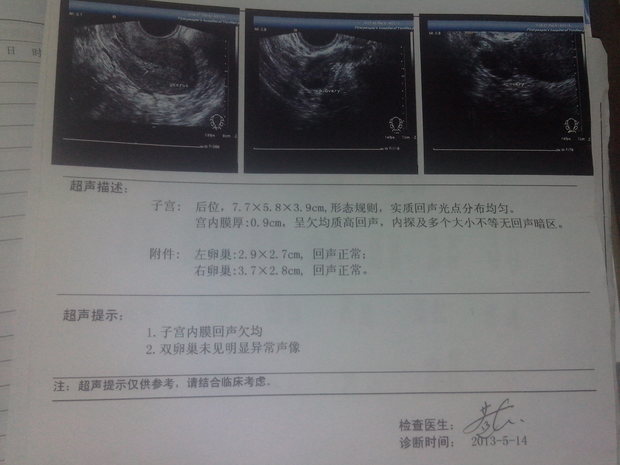 不成功的供卵做代怀试管供卵和子宫肌瘤之间