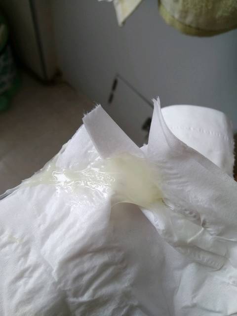 做供卵试管代生怀双胞胎要注意什么？怀双胞