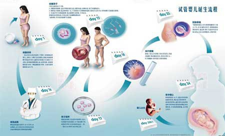供卵试管三代代怀移植后第一天腹水，高龄产妇顺产和剖腹产哪个安全？哪个更适合高龄产妇？