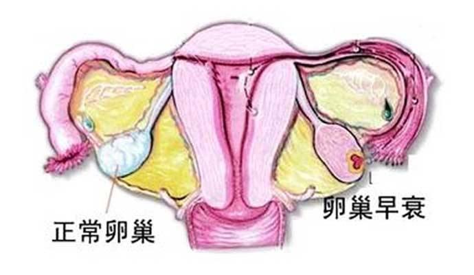 试管三胞胎为什么不能要