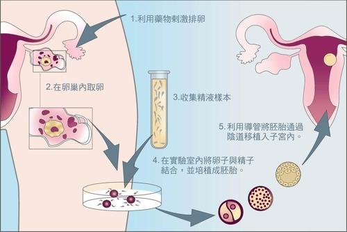 重庆试管婴儿价格表