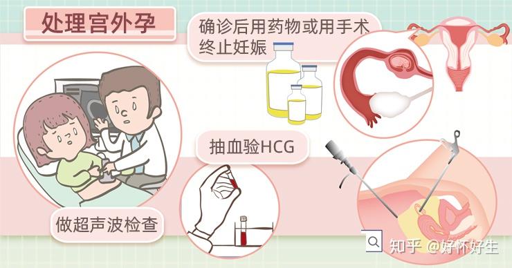 做试管婴儿需要检查什么项目才能进周