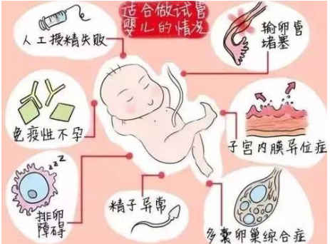 详述试管移植前做宫腔镜的利弊