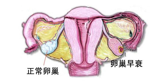 重庆靠谱的代怀公司费用比国内贵几倍真的值得吗+