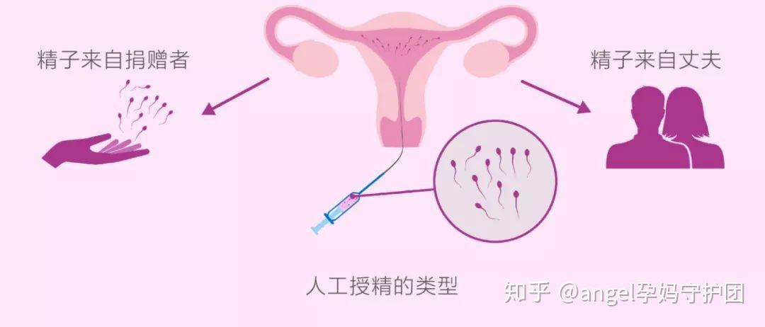 如何在重庆市等待代怀试管机构两周？