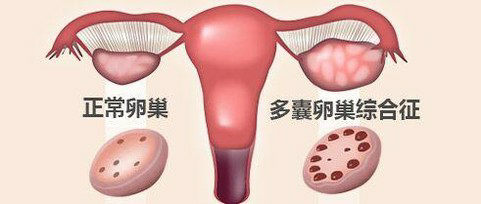 重庆市做代生一孩子收费多少的价格_重庆市做试管的费用