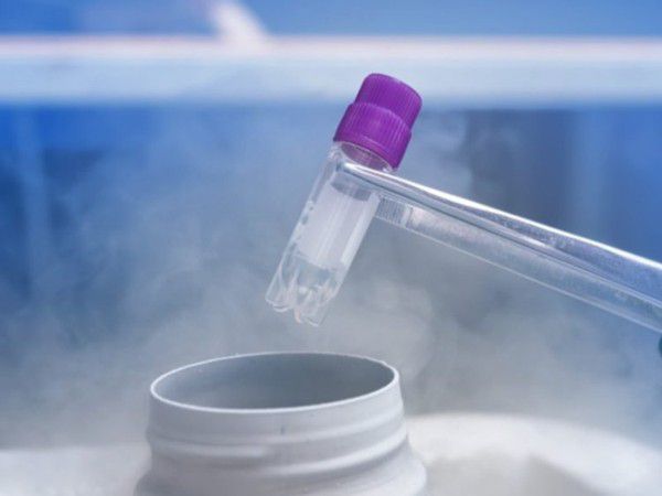 试管和人工受孕有什么区别？主要有这几个区别+