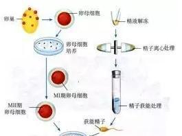 代怀怎么生男孩失败做宫腔镜_试管胚胎移植失败后做宫腔镜检查有意义吗？