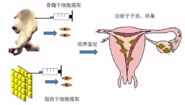 同性恋试管代怀成功率2管3枚是什么意思+