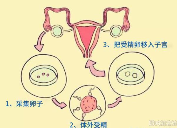 中信湘雅医院是私立还是公立（试管技术好不好？）