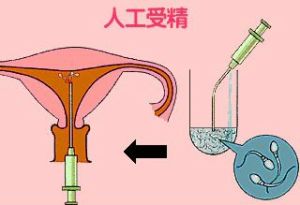 谁有重庆精子库的账号