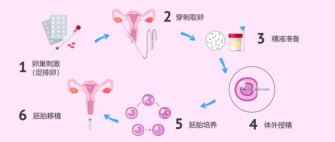 重庆北部妇产医院试管怎么样