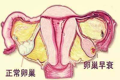 糖尿病代怀宝宝有影响吗+糖尿病影响试管代怀成功率高不高婴儿吗