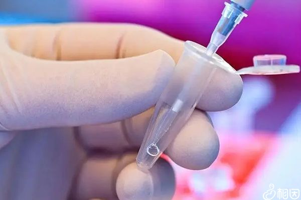 试管代怀产子的费用要不要用激素_国内代生孩子中介前激素检查的必要性!